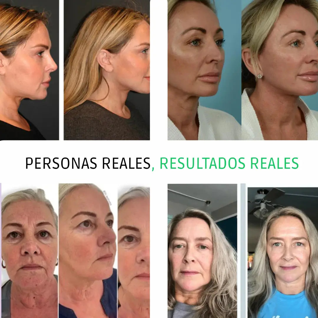 MASAJEADOR FACIAL ELECTRICO